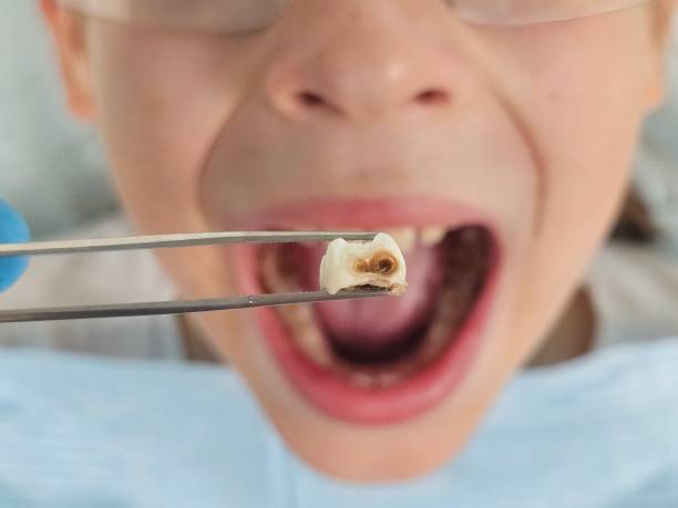 Best Weekend Emergency Dentist in Fairbank, IA